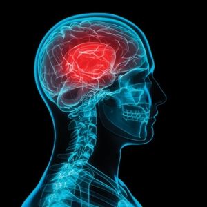 What you Need to Know About Concussions