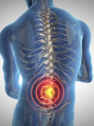 Lumbar Spinal Stenosis - Tidewater Physicians Multispecialty Group