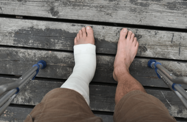 What is a ruptured ligament? 3 Person with broken bone seeking orthopedic care newport news va
