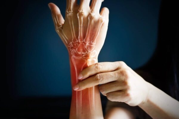 Physical therapy specialists for the wrists and hands 3 Wrist and hand therapy