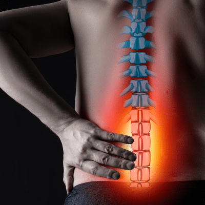 Illustration of spine injuries
